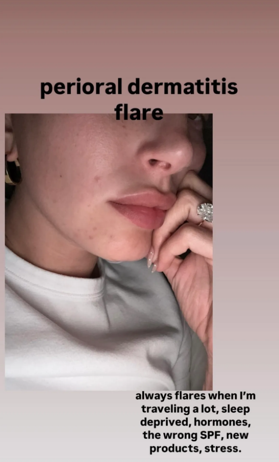 hailey1 12593