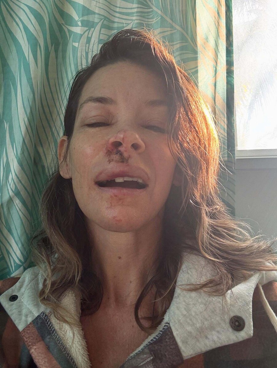 EVANGELINE_LILLY_ACCIDENT_79b2f.jpg