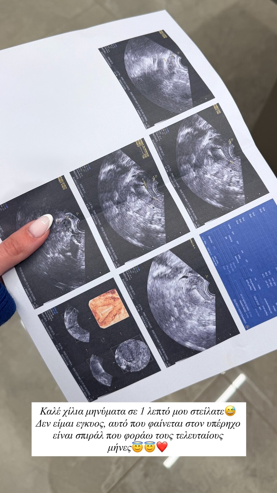 651500233_18565098868012849_1957149430862482864_n_6fe55