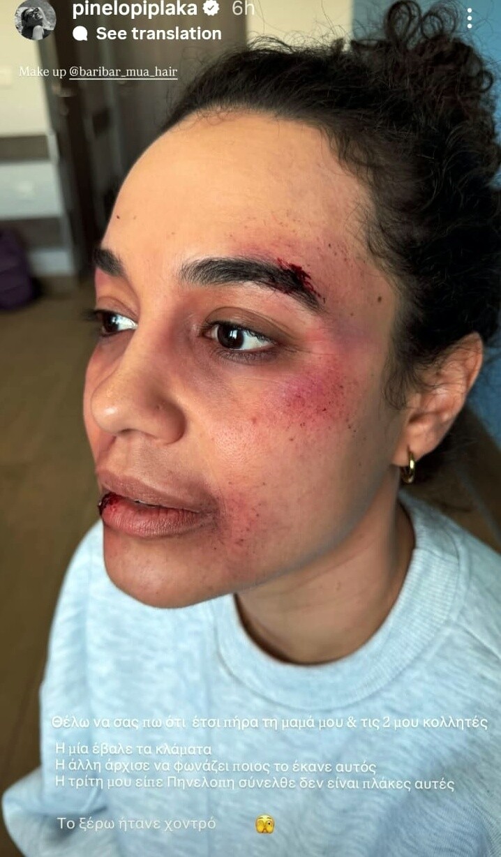PINELOPI_FAKE_TRAVMATISMOS_XONTRI_PLAKA_5e9d8.jpeg