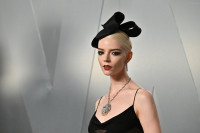 Λιποαναρρόφηση, ενέσεις, οδοντιατρικές θεραπείες… Τα απρόσμενα δώρα που λαμβάνουν οι υποψήφιοι για Όσκαρ