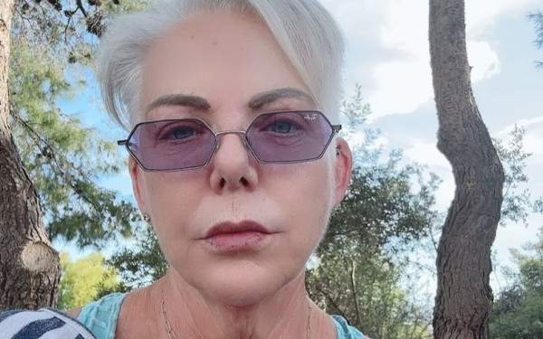 Νανά Παλαιτσάκη: Έκανε neck lift, το είπε δημόσια και άκουσε στα σχολιανά της