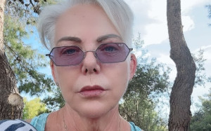 Νανά Παλαιτσάκη: Έκανε neck lift, το είπε δημόσια και άκουσε στα σχολιανά της
