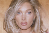 Τι είναι οι βιοδιεγερτικές ενέσεις, το νέο Botox που υπόσχεται πιο φυσικά αποτελέσματα;