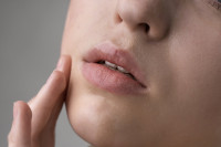 «Έχει γίνει ανησυχητικό»: Χειρουργός προειδοποιεί για τους κινδύνους του lip lift