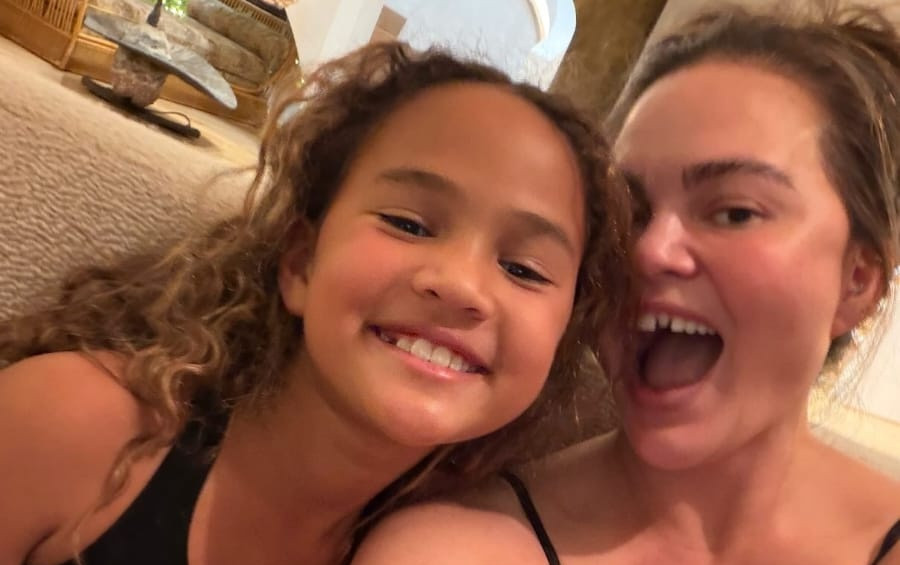 Chrissy Teigen: Έχασε ένα δόντι σε μια χριστουγεννιάτικη παράδοση με τα παιδιά της και δείτε πώς αντέδρασε