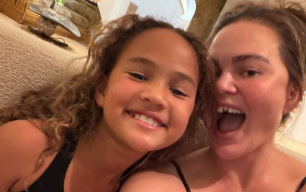 Chrissy Teigen: Έχασε ένα δόντι σε μια χριστουγεννιάτικη παράδοση με τα παιδιά της και δείτε πώς αντέδρασε