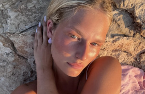 «Lip filler accent»: Αυτός ο νέος τρόπος ομιλίας, εμπνευσμένος από τις ενέσεις, προβληματίζει τους ειδικούς