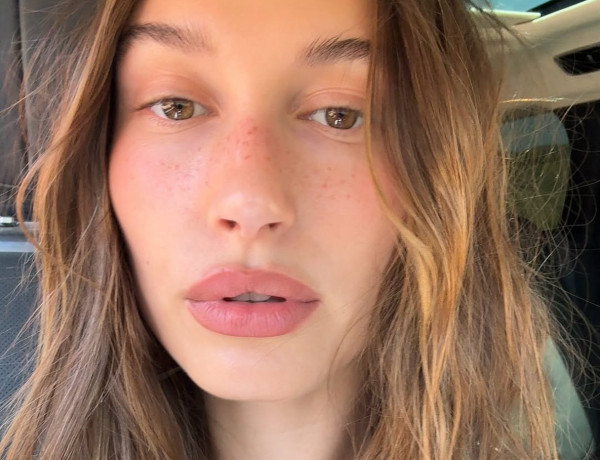 Hailey Bieber: Μιλάει ανοιχτά για την περιστοματική δερματίτιδα και εξηγεί πώς την αντιμετωπίζει όταν εμφανίζεται