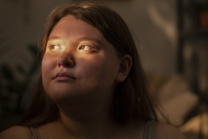 «Cortisol face»: Μπορεί το στρες να προκαλέσει πραγματικά πρήξιμο στο πρόσωπο;