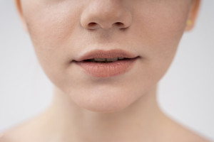 Lip basting: Το παράξενο beauty trick που μεταφέρει μια τεχνική του skincare στα σκασμένα χείλη